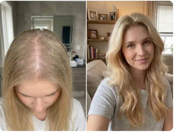 Prima e dopo Sofia D. 33 anni