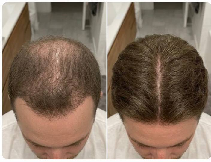 Prima e dopo Alessandro R., 34 anni